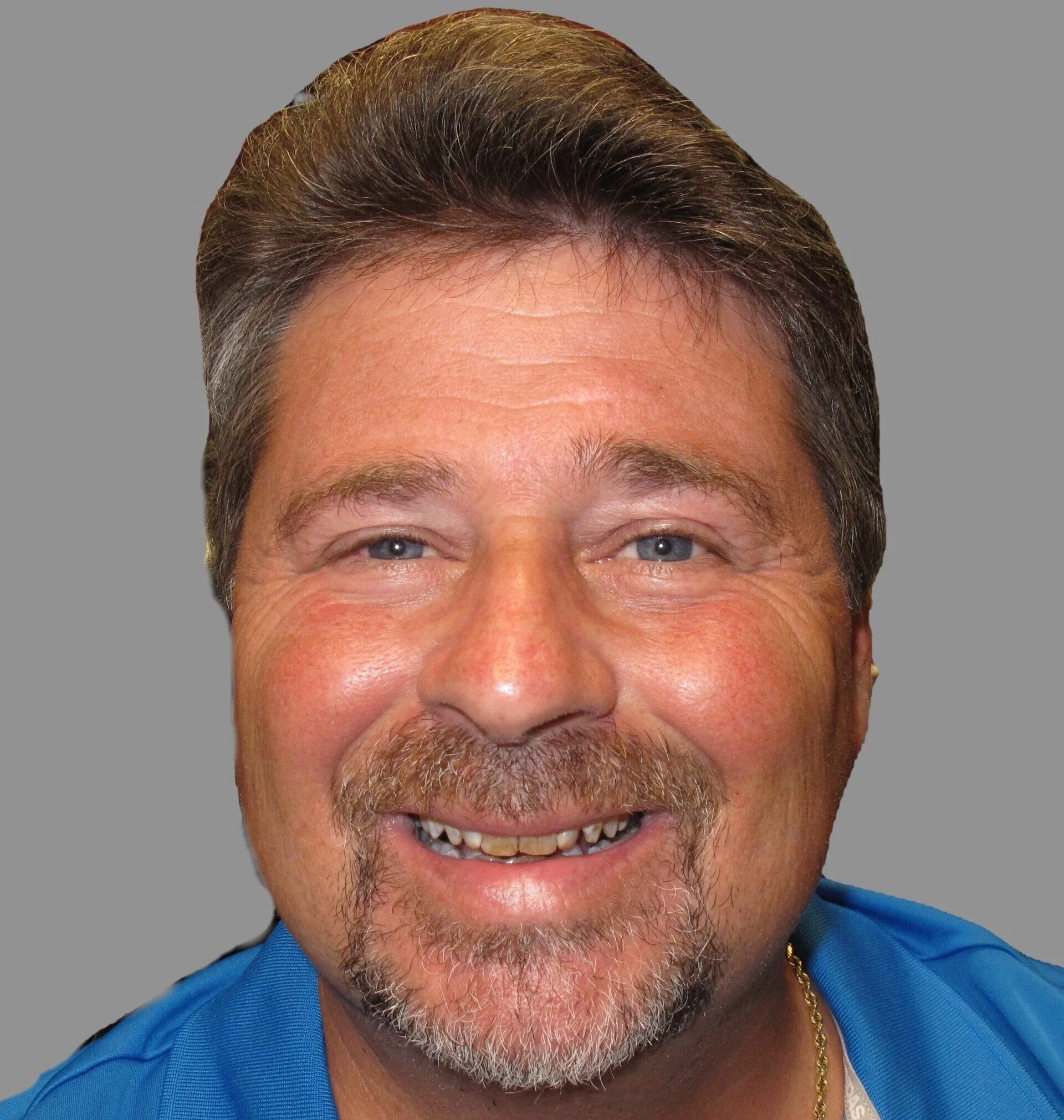 Male dentist in blue scrubs smiling at camera against gray background.