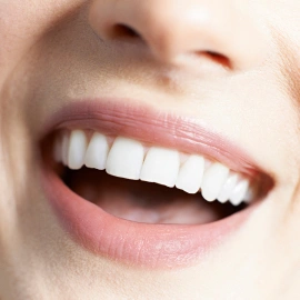 Close-up of person smiling, displaying bright white teeth and healthy gums in professional dental setting.