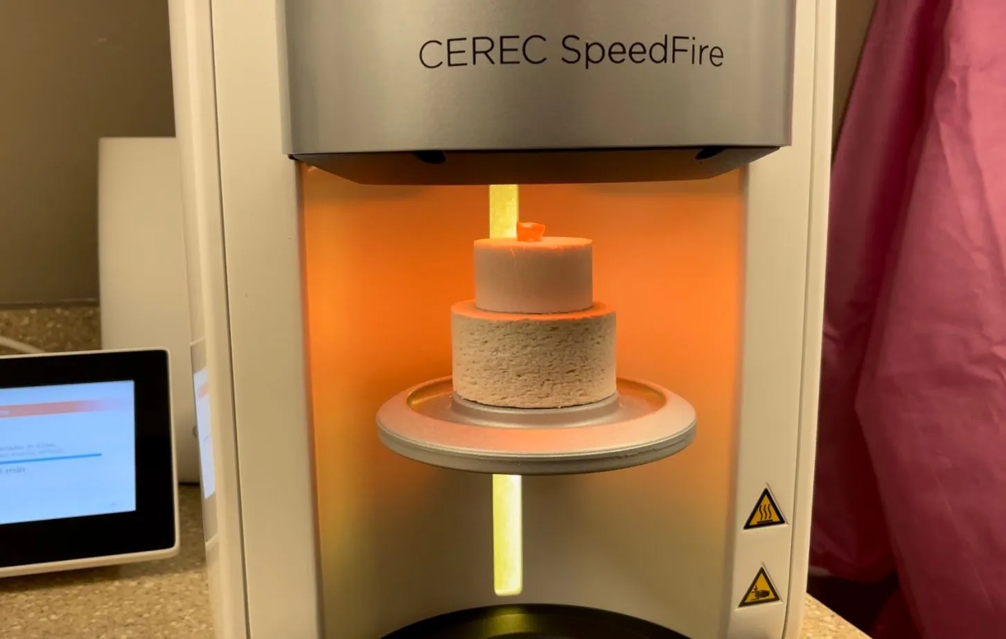 CEREC SpeedFire dental milling machine with ceramic crown being fabricated in dental laboratory setting.