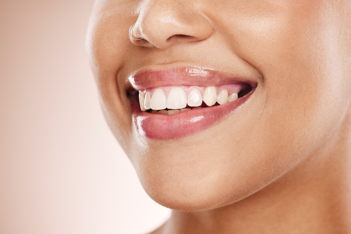 Cosmetic Dentistry