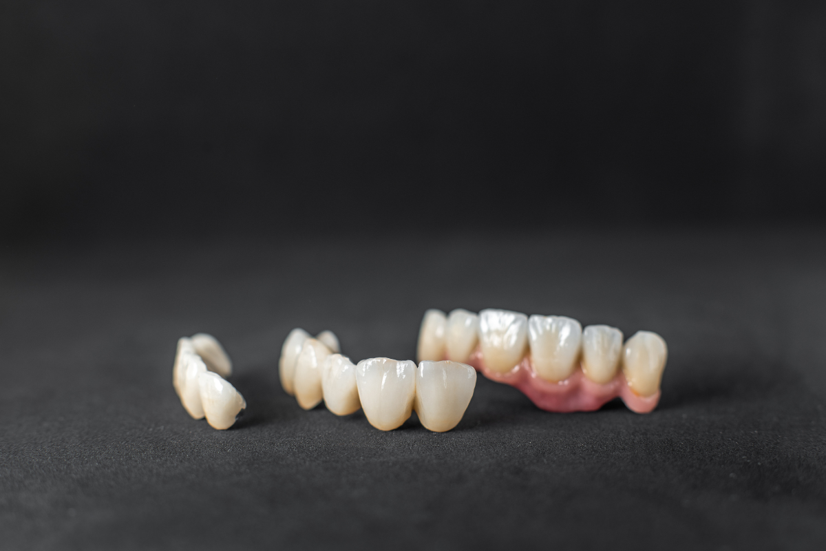 Dental Crowns Care Tips