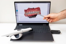 Digital design of a CEREC same-day dental crown